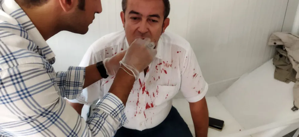 ÇGC’den AHaber muhabiri Halil İbrahim Uğur’a yapılan saldırı girişimine tepki…